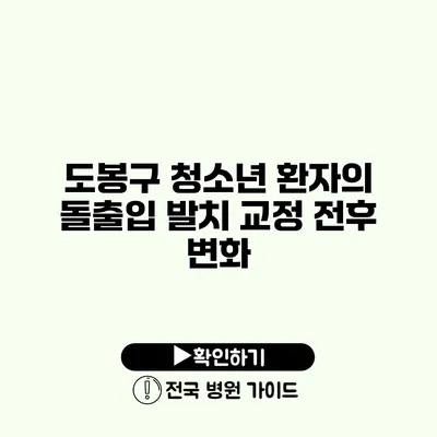 도봉구 청소년 환자의 돌출입 발치 교정 전후 변화