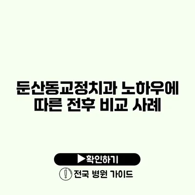 둔산동교정치과 노하우에 따른 전후 비교 사례